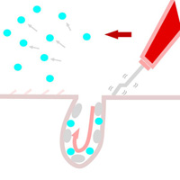 毛穴洗浄のイメージ図