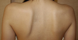 矯骨気療法 お客様のお声2 施術前