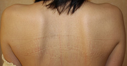 矯骨気療法 お客様のお声2 施術後　